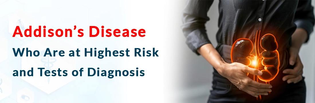  Addison’s Disease: Who Are at Highest Risk and Tests of Diagnosis